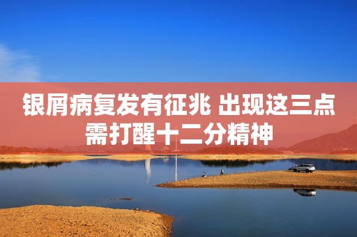 银屑病复发有征兆 出现这三点需打醒十二分精神