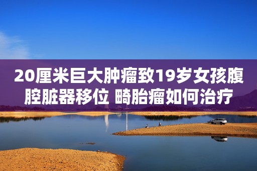 20厘米巨大肿瘤致19岁女孩腹腔脏器移位 畸胎瘤如何治疗