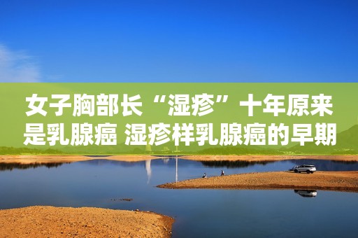 女子胸部长“湿疹”十年原来是乳腺癌 湿疹样乳腺癌的早期症状