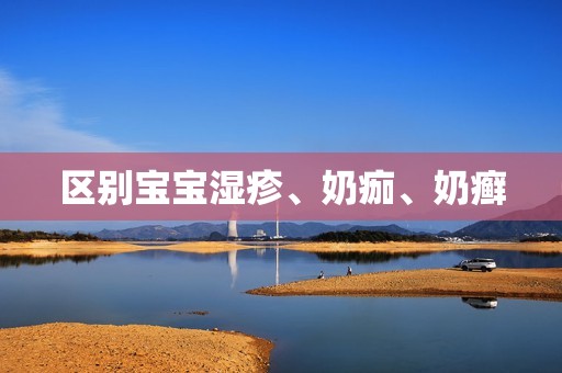 区别宝宝湿疹、奶痂、奶癣