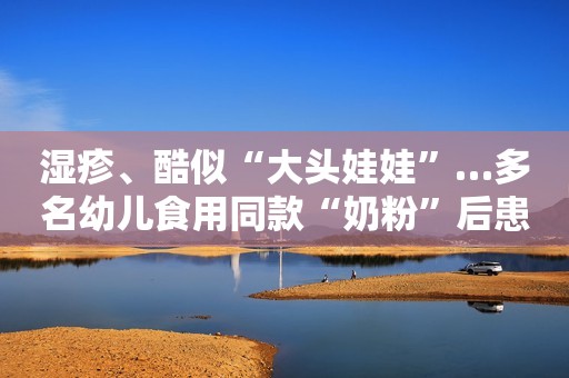 湿疹、酷似“大头娃娃”…多名幼儿食用同款“奶粉”后患同一种病，当地成立调查组