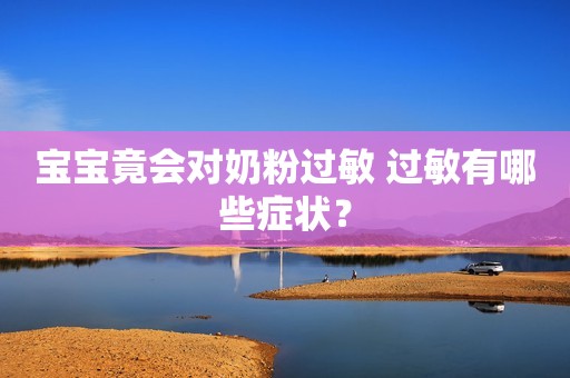 宝宝竟会对奶粉过敏 过敏有哪些症状？