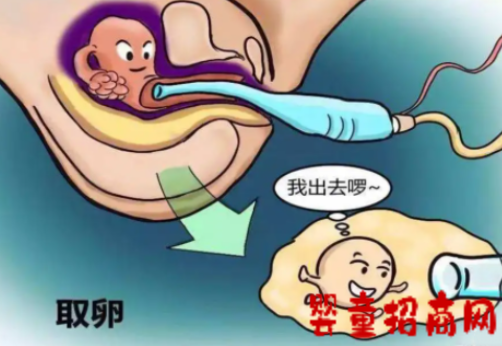 取卵后不移植要吃药吗？